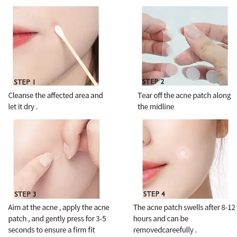 Invisible Acne Patches Removal Pimple Anti-Acne Hydrocolloid Patches Spots Marks Concealer Repair Sticker Waterproof