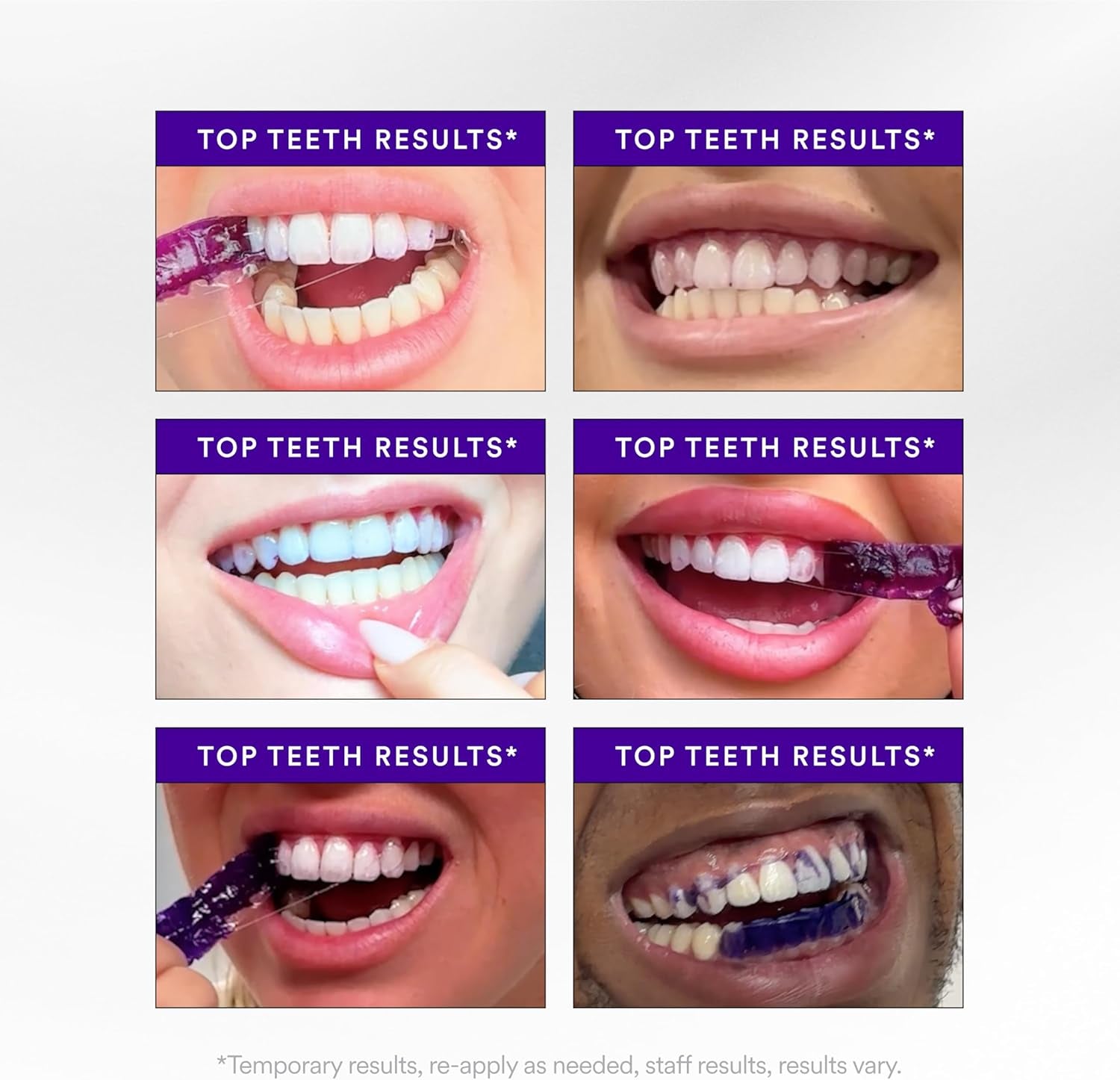 V34 Purple Teeth Whitening Strips – Stain Removal with Whitening & Color Correct