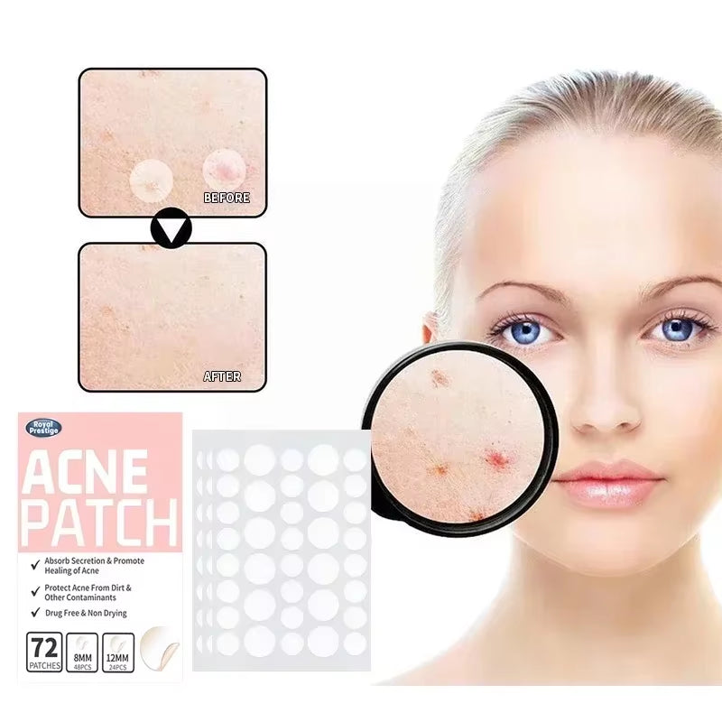 Invisible Acne Patches Removal Pimple Anti-Acne Hydrocolloid Patches Spots Marks Concealer Repair Sticker Waterproof